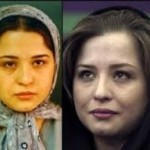 حداقل سن متقاضیان جراحی بینی حداقل سن متقاضیان جراحی بینی