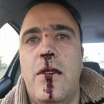 بینی افشاگر پشت پرده استقلال را شکستند +عکس بینی افشاگر پشت پرده استقلال را شکستند +عکس