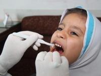 اجرای طرح سلامت دهان و دندان در مدارس زنجان