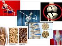 پوکی استخوان موریانه ساختمان بدن/اقلیم اردبیل مانع جذب ویتامین دی